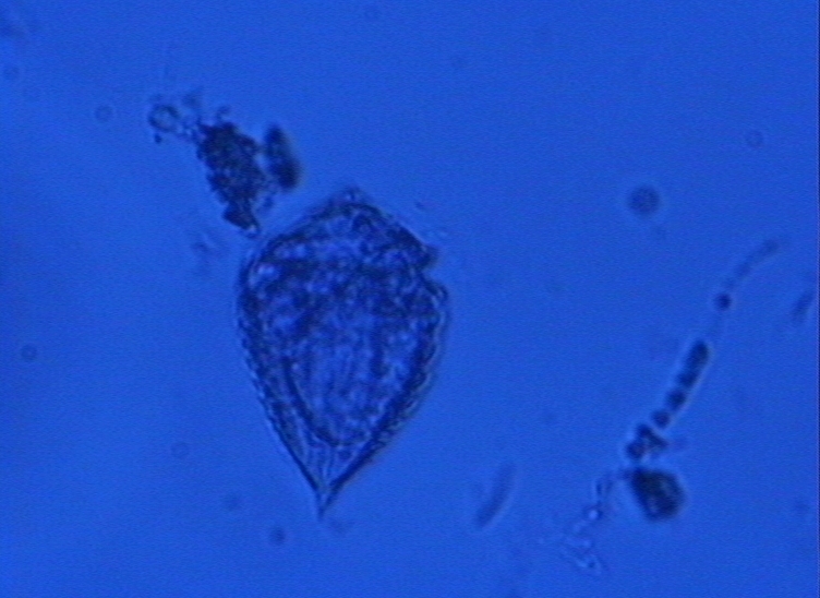 Dictyocha speculum